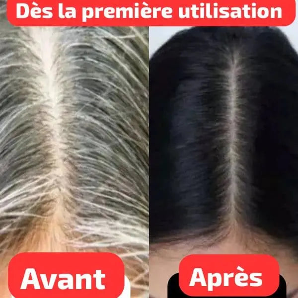 Shampoing 3 en 1 – Pousse Rapide + Anti-Cheveux Blancs + Brillance Intense Ô Marché