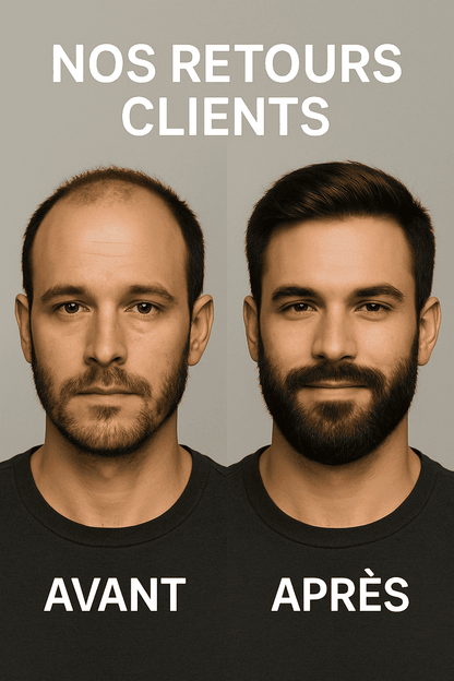 Huile Repousse Express : Cheveux & Barbe ( 50% réduction + Livraison GRATUITE ) Ma Boutique