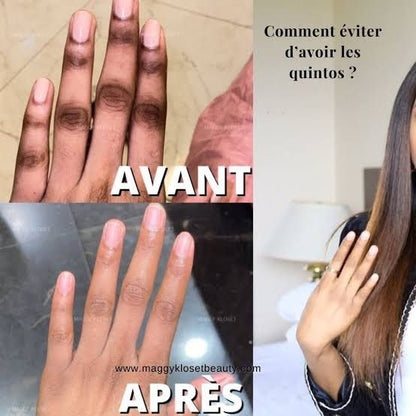 Solution Anti Quinto, Tâches et Boutons Après Rasage - Peau Parfaite en 7 Jours